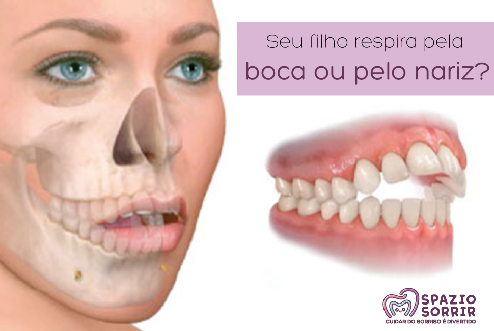 Postagem Seu filho respira pela boca ou pelo nariz?