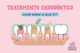 Postagem Tratamento endodôntico, você sabe o que é?